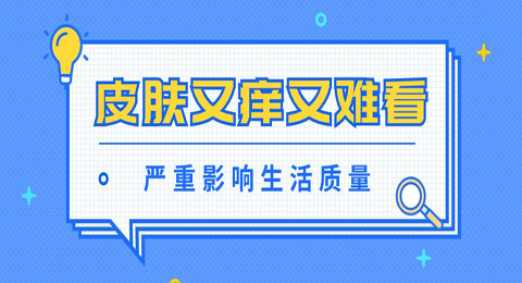 结节性痒疹 | 皮肤又痒又难看，严重影响生活质量！