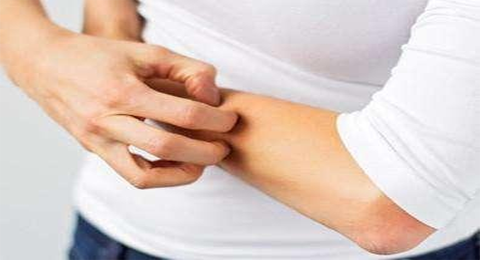 为什么急性湿疹发病快，好的却很慢？