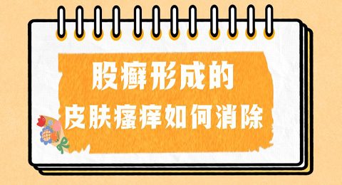 股癣形成的皮肤瘙痒如何消除？