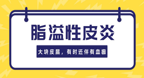 头上超大块头皮屑，有时还伴有血痂是脂溢性皮炎吗？