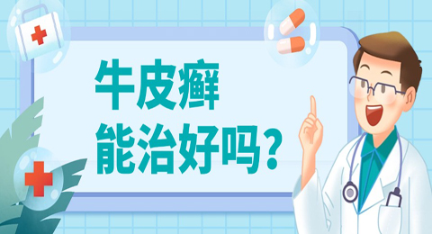 牛皮癣能治好吗？