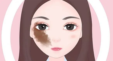 【胎记科普】警惕！太田痣有这些并发症，你都知道吗？