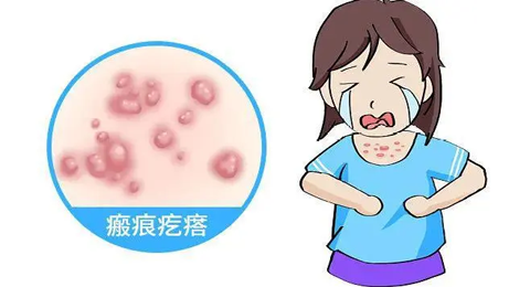 【疤痕科普】为什么前胸是疤痕疙瘩的重灾区？