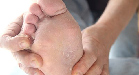 脚趾脱皮特别痒，你还在等什么？
