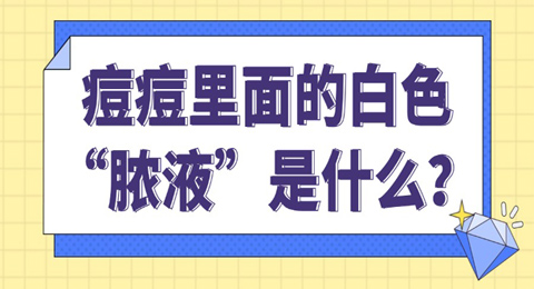 痘痘里面的白色”脓液“是什么？可以挤吗