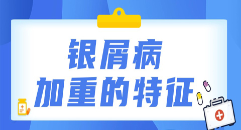 银屑病又加重？四大症状表现要警惕，尽早治疗很重要！